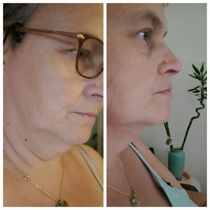 ALLVERO™  Çene Toparlayıcı Maske – Gıdı Karşıtı Kolajen Maske